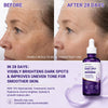 Lumivelle Advanced Dark Spot &amp; Brightening Serum