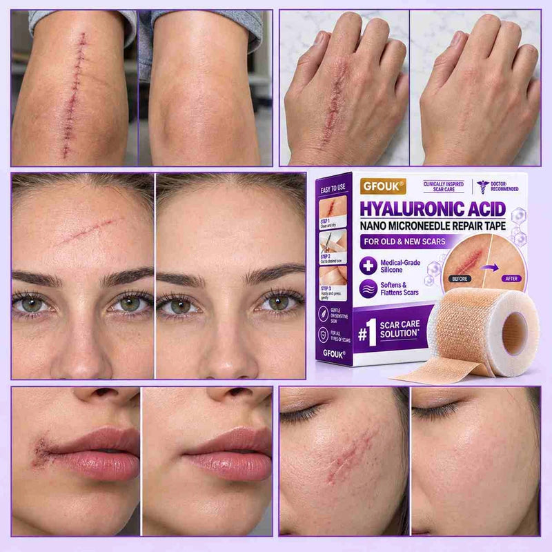 ScarLuxe Advanced Nano Microneedle Scar Care Tape