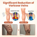 VeinTarget Microneedle Patch