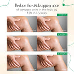 Vein Therapy Cream