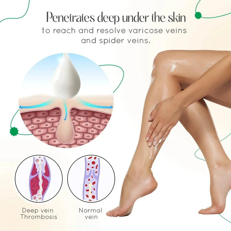 Vein Therapy Cream