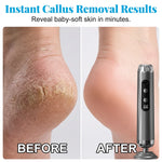 Electric Foot Grinder