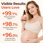 SilkStretch Body Care Oil