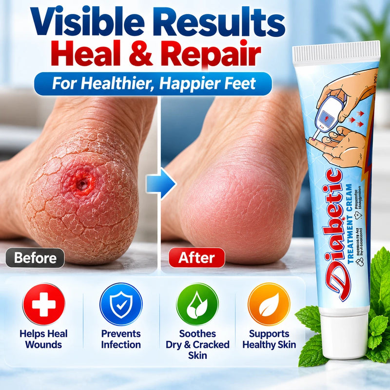 Diabetic Foot Cream for Cracked Heels