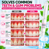 Sensitive Teeth Repair Gel