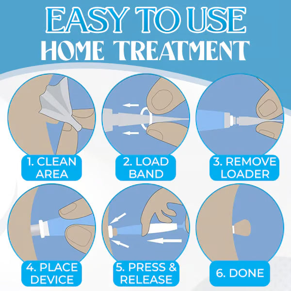 Auto Micro Skin Tag Remover