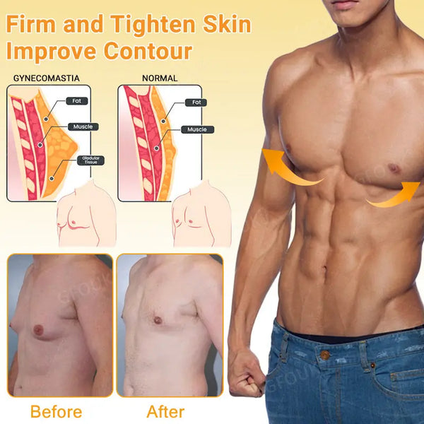 GFOUK® Tamoxifen GLP-1 Gynecomastia Shaping Patch