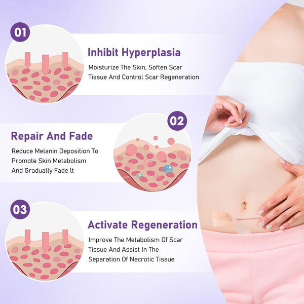 Hyaluronic Acid Silicone Scar Tape