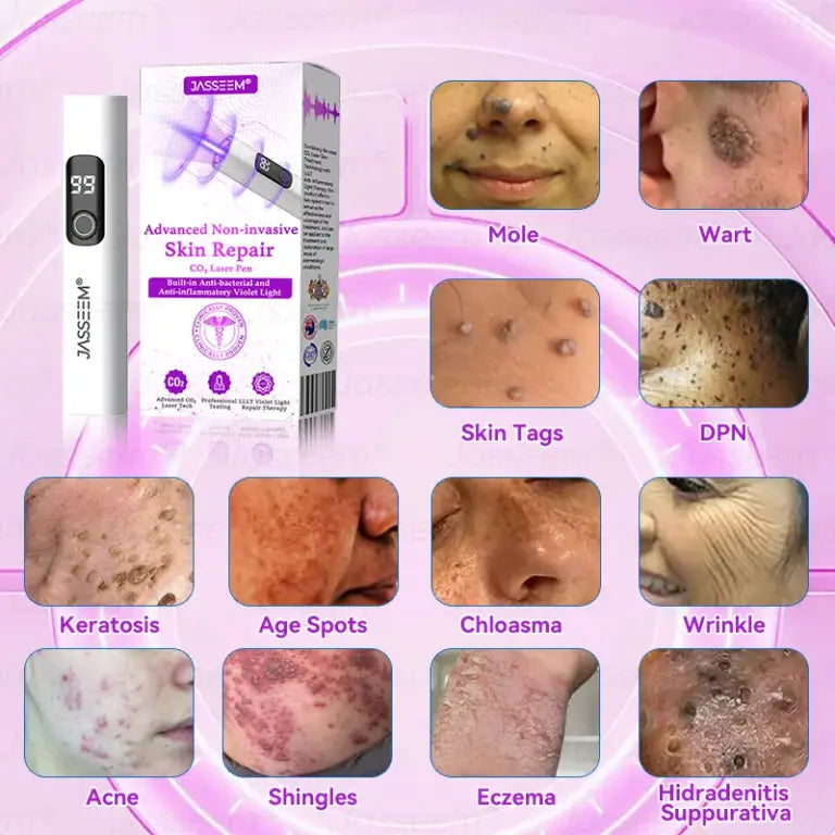 Advanced Non-Invasive Skin Repair CO₂ Laser Pen