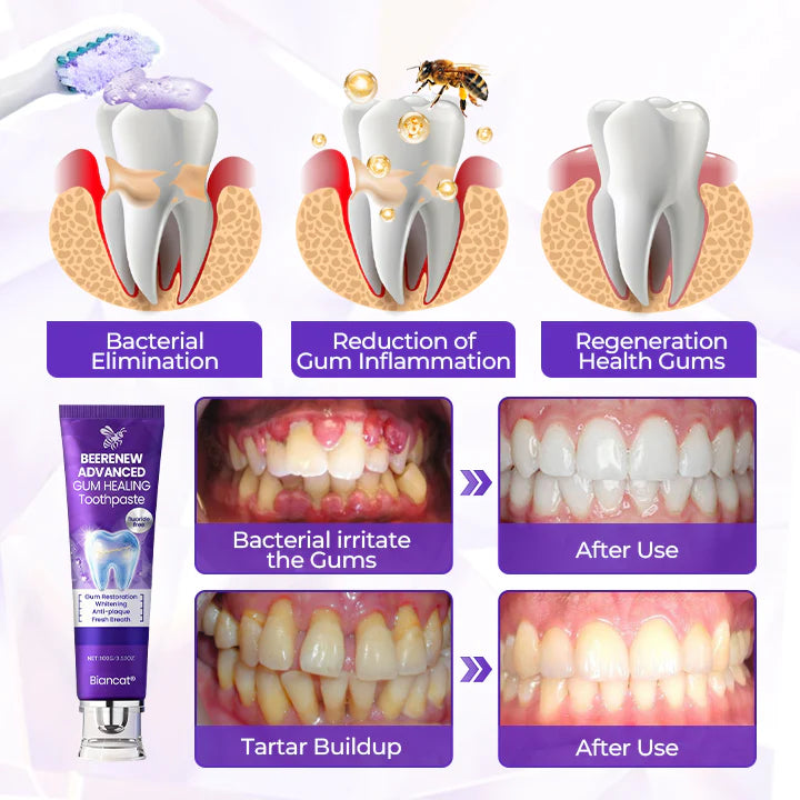 BeeRenew Advanced Gum Healing Toothpaste